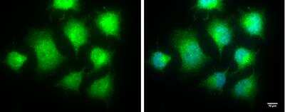 Immunocytochemistry/ Immunofluorescence: IKK epsilon/IKBKE Antibody [NBP1-33052]