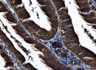 Immunohistochemistry-Paraffin: IKK epsilon/IKBKE Antibody [NBP1-33052]