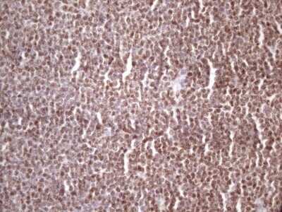 Immunohistochemistry: IKK epsilon/IKBKE Antibody (OTI3C5) - Azide and BSA Free [NBP2-71490]