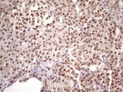 Immunohistochemistry: IKK epsilon/IKBKE Antibody (OTI3C5) - Azide and BSA Free [NBP2-71490]