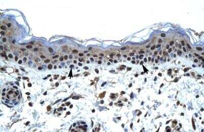Immunohistochemistry-Paraffin: IKZF5 Antibody [NBP1-80021]