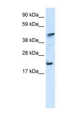 Western Blot: IKZF5 Antibody [NBP1-80021]