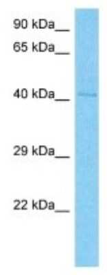 Western Blot: IKZF5 Antibody [NBP3-09970]