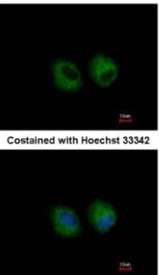 Immunocytochemistry/ Immunofluorescence: IL-1 RII Antibody [NBP1-32681]
