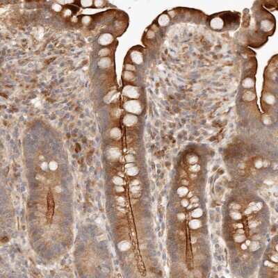Immunohistochemistry-Paraffin: IL-1 RII Antibody [NBP1-86550]