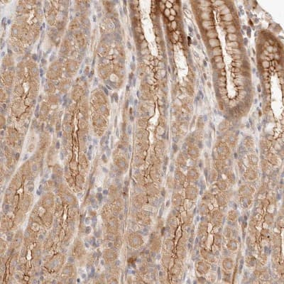 Immunohistochemistry-Paraffin: IL-1 RII Antibody [NBP1-86550]