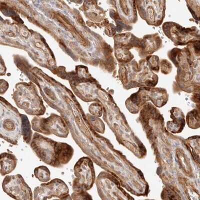 Immunohistochemistry-Paraffin: IL-1 RII Antibody [NBP1-86550]