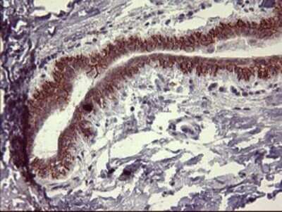 Immunohistochemistry: IL-1 alpha/IL-1F1 Antibody (OTI2F8) [NBP2-45400]