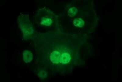 Immunocytochemistry/ Immunofluorescence: IL-1 alpha/IL-1F1 Antibody (OTI2F8) - Azide and BSA Free [NBP2-71021]