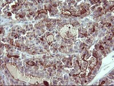 Immunohistochemistry: IL-1 alpha/IL-1F1 Antibody (OTI2F8) - Azide and BSA Free [NBP2-71021]