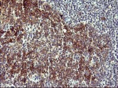 Immunohistochemistry: IL-1 alpha/IL-1F1 Antibody (OTI2F8) - Azide and BSA Free [NBP2-71021]