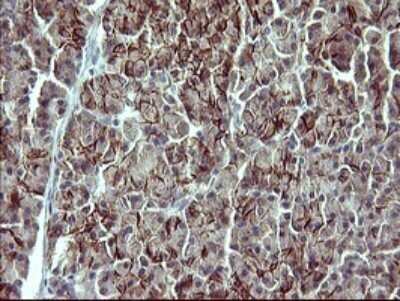 Immunohistochemistry: IL-1 alpha/IL-1F1 Antibody (OTI2F8) - Azide and BSA Free [NBP2-71021]