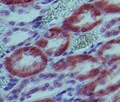 Immunohistochemistry-Paraffin: IL-1 beta/IL-1F2 Antibody (43N3D8) - BSA Free [NBP2-27345]