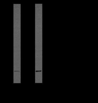 Western Blot: IL-1 beta/IL-1F2 Antibody (43N3D8)BSA Free [NBP2-27345]