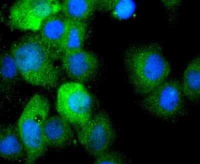 Immunocytochemistry/ Immunofluorescence: IL-1 beta/IL-1F2 Antibody (JJ087-3) [NBP2-67865]