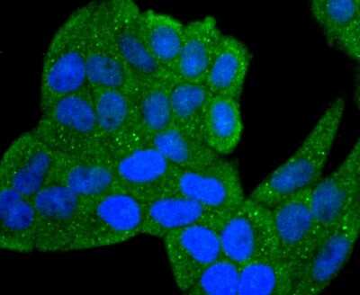 Immunocytochemistry/ Immunofluorescence: IL-1 beta/IL-1F2 Antibody (JJ087-3) [NBP2-67865]