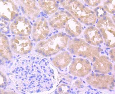 Immunohistochemistry-Paraffin: IL-1 beta/IL-1F2 Antibody (JJ087-3) [NBP2-67865]