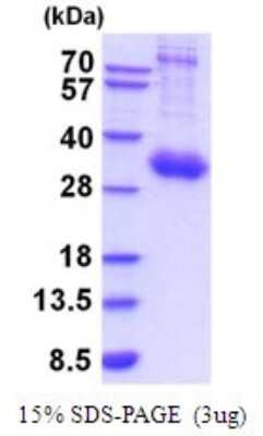 SDS-PAGE: Recombinant Human IL-10R alpha His Protein [NBP2-52077]