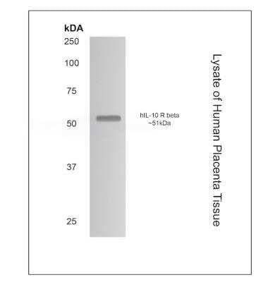 Western Blot: IL-10 R beta Antibody (MM0360-8R24)Azide and BSA Free [NBP2-11654]