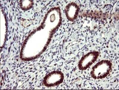 Immunohistochemistry: IL-10R alpha Antibody (OTI1D10) - Azide and BSA Free [NBP2-71030]