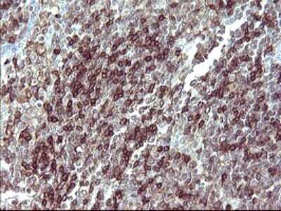 Immunohistochemistry: IL-10R alpha Antibody (OTI1D10) - Azide and BSA Free [NBP2-71030]