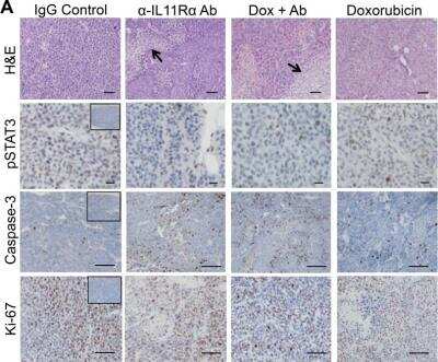 Immunohistochemistry-Paraffin: IL-11R alpha Antibody [NBP1-62351]