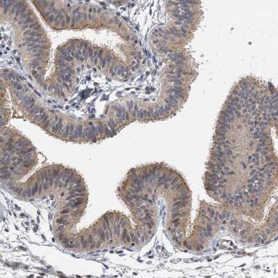 Immunohistochemistry-Paraffin: IL-11R alpha Antibody [NBP2-31997]