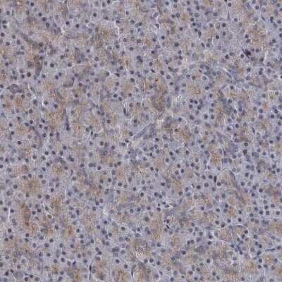 Immunohistochemistry-Paraffin: IL-11R alpha Antibody [NBP2-31997]