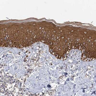 Immunohistochemistry-Paraffin: IL-11R alpha Antibody [NBP2-31997]