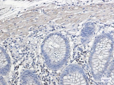 Immunohistochemistry-Paraffin: IL-11R alpha Antibody (S08-2J3) [NBP3-19662]