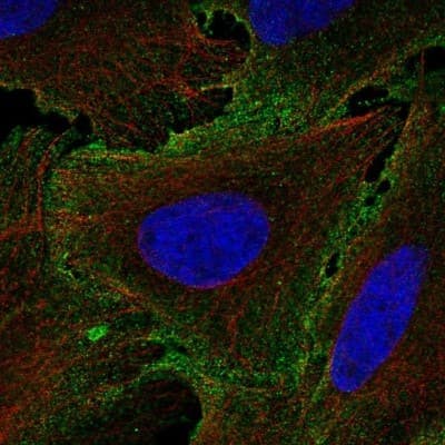 Immunocytochemistry/ Immunofluorescence: IL-12 R beta 1 Antibody [NBP2-57287]