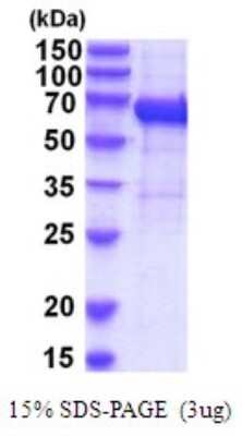 SDS-PAGE: Recombinant Human IL-12 R beta 1 His Protein [NBP2-52085]