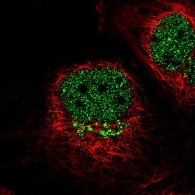 Immunocytochemistry/ Immunofluorescence: IL-13R alpha 1 Antibody [NBP2-55120]