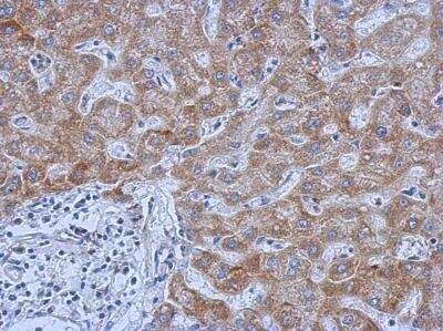 Immunohistochemistry-Paraffin: IL-13R alpha 1 Antibody [NBP2-16942]