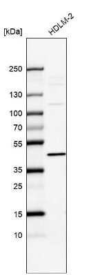 Western Blot: IL-13R alpha 1 Antibody [NBP2-55120]