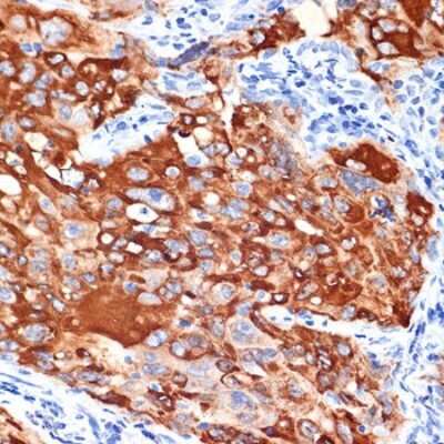 Immunohistochemistry-Paraffin: IL-13R alpha 1 Antibody (5A3W5) [NBP3-16207]