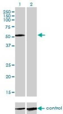 Western Blot: IL-13R alpha 2 Antibody (2E10) [H00003598-M01]