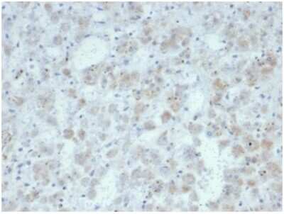 Immunohistochemistry-Paraffin: IL-15 Antibody (IL15/7048R) [NBP3-13950]