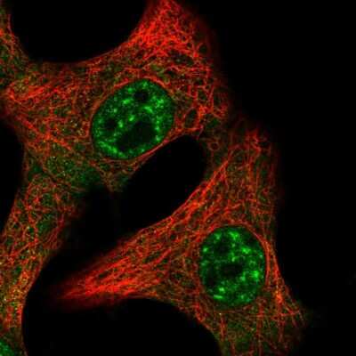 Immunocytochemistry/ Immunofluorescence: IL-15 Antibody [NBP2-55162]