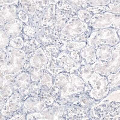 Immunohistochemistry-Paraffin: IL-17/IL-17A Antibody (CL10252) [NBP3-07997]
