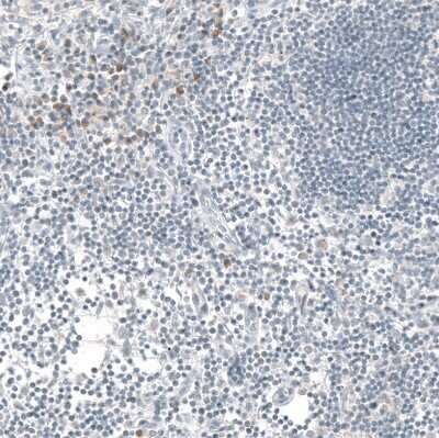 Immunohistochemistry-Paraffin: IL-17/IL-17A Antibody (CL10252) [NBP3-07997]