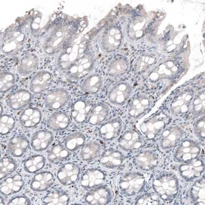 Immunohistochemistry-Paraffin: IL-17/IL-17A Antibody (CL10252) [NBP3-07997]