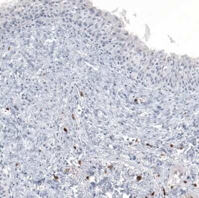 Immunohistochemistry-Paraffin: IL-17/IL-17A Antibody (CL10252) [NBP3-07997]