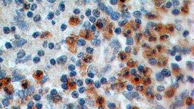 Immunohistochemistry-Paraffin: IL-17RA/IL-17R Antibody (49M4D2) - BSA Free [NBP2-25258]