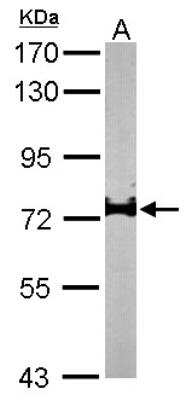 Western Blot: IL-17RD/SEF Antibody [NBP1-32307]