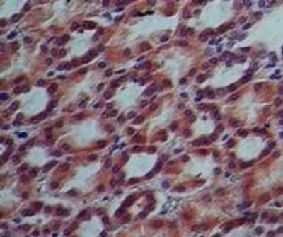 Immunohistochemistry-Paraffin: IL-17RE Antibody (46N7E3) - Azide Free [NBP2-27367]