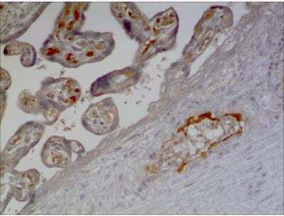 Immunohistochemistry-Paraffin: IL-17B Antibody (MM0373-3D62) - Azide and BSA Free [NBP2-11672]