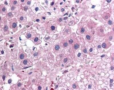 Immunohistochemistry: IL-17E/IL-25 Antibody (68C1039.2) - Azide Free [NBP2-33223]