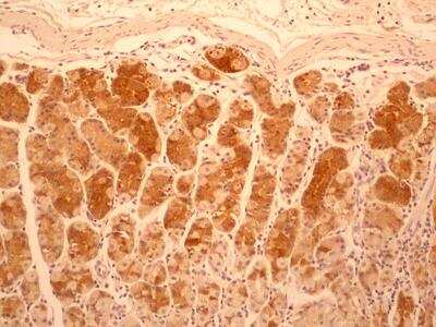 Immunohistochemistry-Paraffin: IL-17F Antibody (4H1629.1) - BSA Free [NBP2-27327]