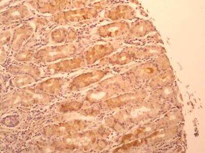 Immunohistochemistry-Paraffin: IL-17F Antibody (4H1629.1) - BSA Free [NBP2-27327]